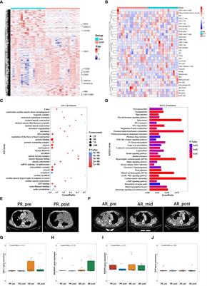 Integrative analysis of blood transcriptome profiles in small-cell lung cancer patients for identification of novel chemotherapy resistance-related biomarkers